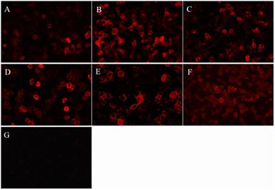 Clinical Features and Outcomes in Pediatric Autoimmune Encephalitis Associated With CASPR2 Antibody